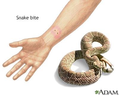 8928 - Dream About Snake Bite On Leg – Analysis and Explanation