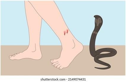 074431.jpg67142cf35fb45 - Dream About Snake Bite Leg In Islam – Causes and Interpretations