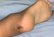 3 2529.jpg67142cdd80ff7 220x150 - Dream About Snake Bite Leg In Islam – Causes and Interpretations