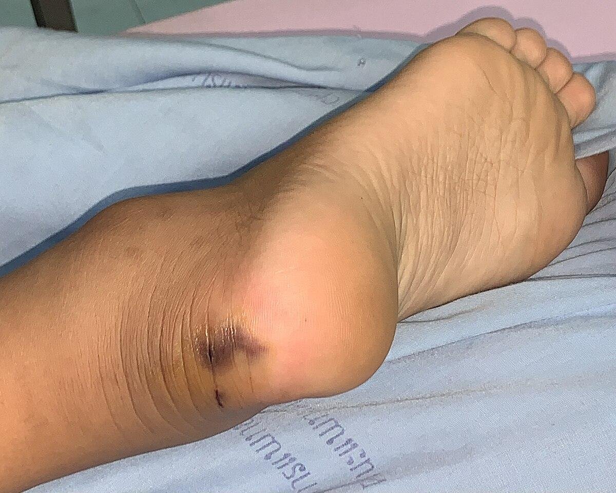3 2529.jpg67142cdd80ff7 - Dream About Snake Bite Leg In Islam – Causes and Interpretations
