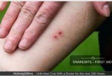 3897 dream about snake bite on right leg hidden messages and insights 220x150 - Dream About A Venomous Snake Biting Me – Spiritual and Psychological Insights