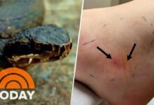 Dream About Snake Bite On Foot – What It Represents