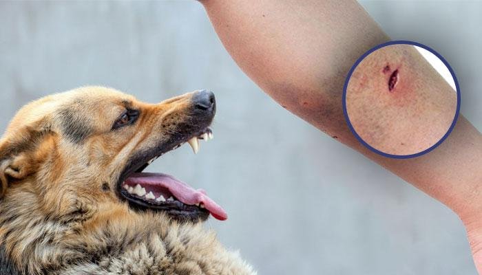 Biting.jpg67105a1eed81a - Dream About Dog Bite On Hand – Spiritual and Psychological Insights