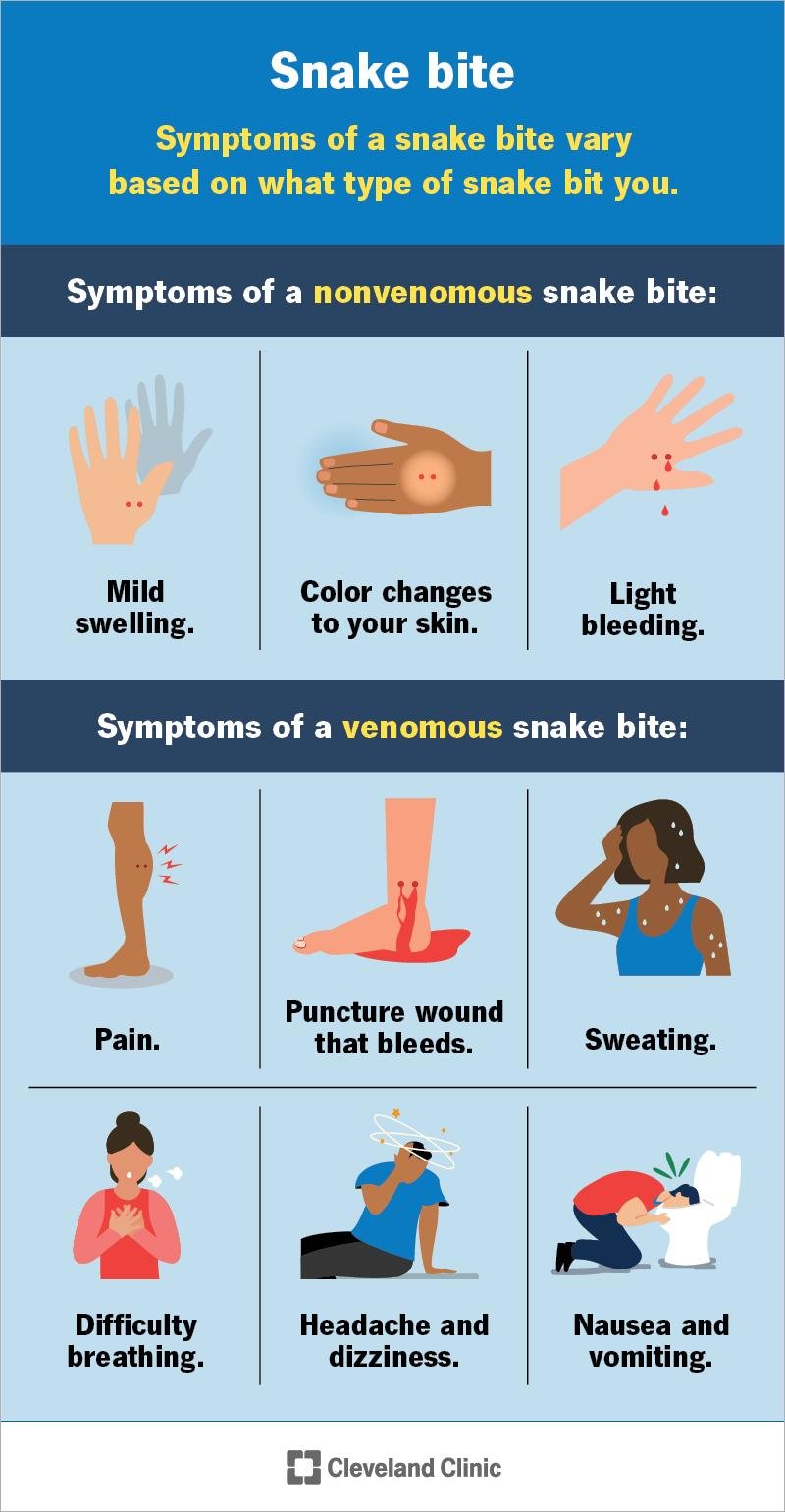 e bite - Dream About Snake Bite – Causes and Interpretations