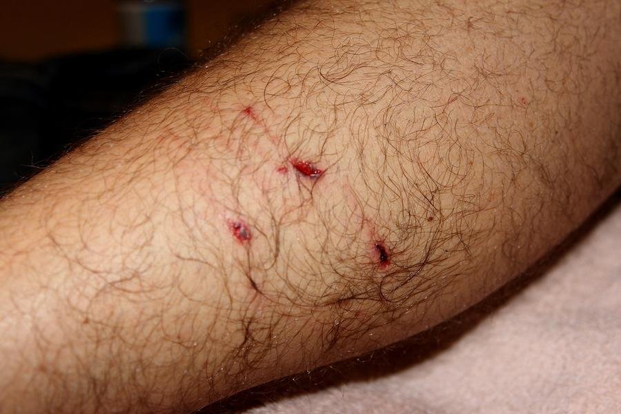 injury.jpg67105a245002a - Dream About Dog Bite On Hand – Spiritual and Psychological Insights