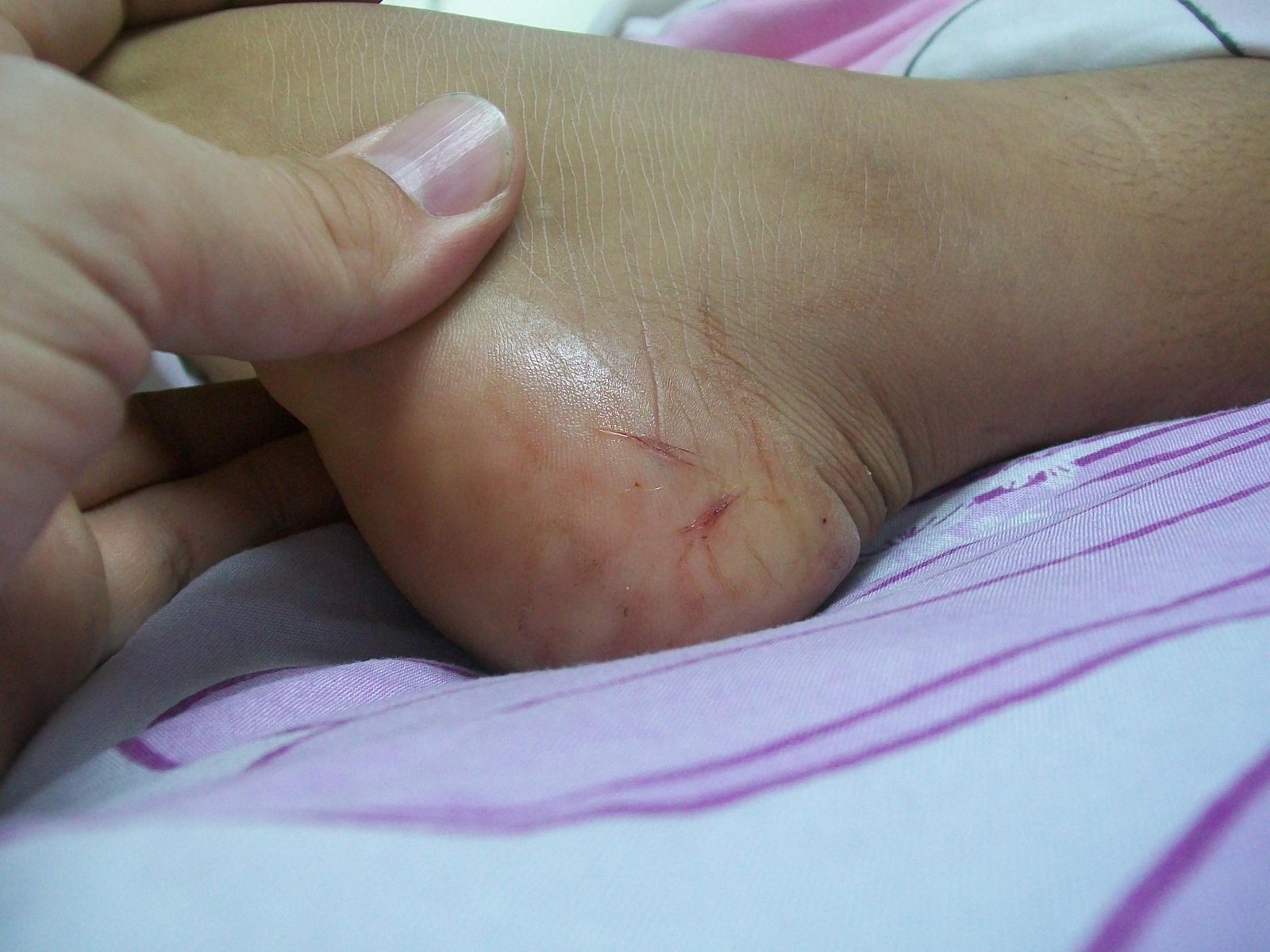 injury.jpg67142ce2dca8b - Dream About Snake Bite Leg In Islam – Causes and Interpretations