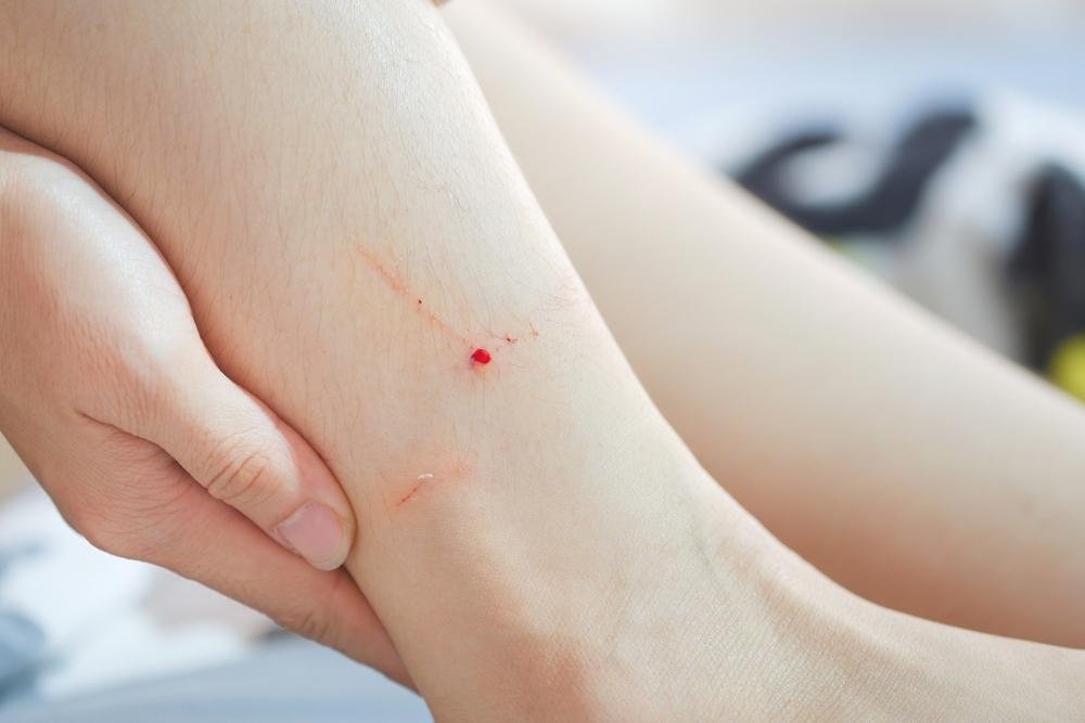 tock 1.jpg6713557330d9d - Dream About Getting Bitten By A Cat – Symbolism and Significance